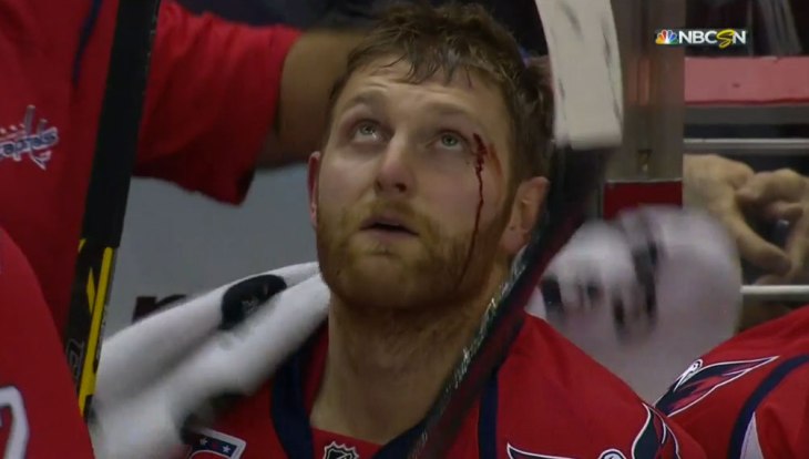 karl-alzner-eye.jpg